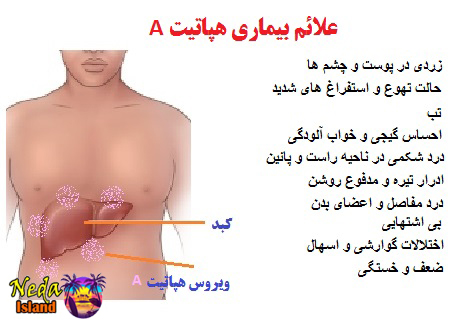 علائم بیماری هپاتیت A