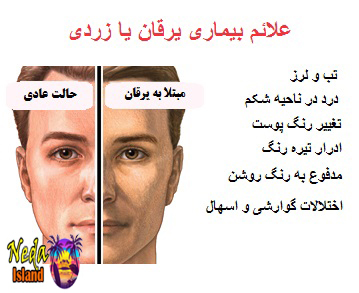  علائم بيماري یرقان