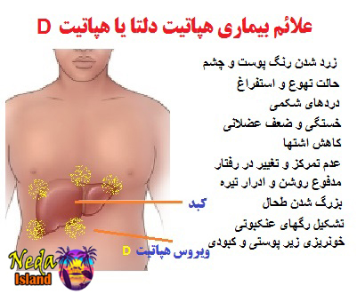 علائم بيماري هپاتیت دی