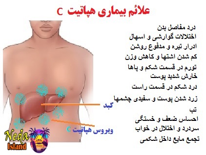 علائم بيماري هپاتیت سی