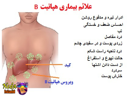 علائم بيماري هپاتیت بی