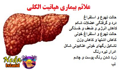 علائم بيماري هپاتیت الکلی