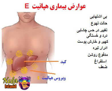 علائم بيماري هپاتیت ای
