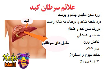 علائم بيماري سرطان کبد