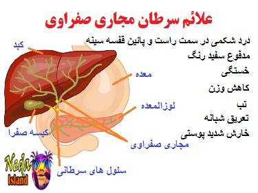 علائم بيماري سرطان مجاری صفراوی