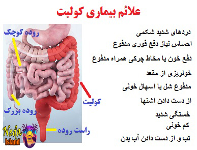 علائم بيماري کولیت