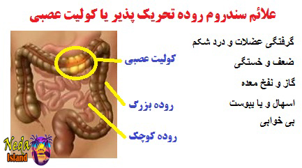 علائم بيماري کولیت عصبی