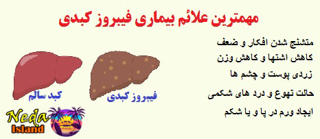 علائم بيماري فیبروز کبدی