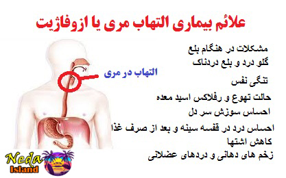 علائم بيماري التهاب مری