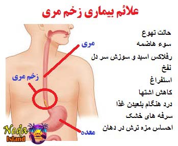 علائم زخم مری