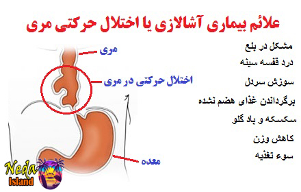 علائم بیماری آشالازی یا اختلال حرکتی مری