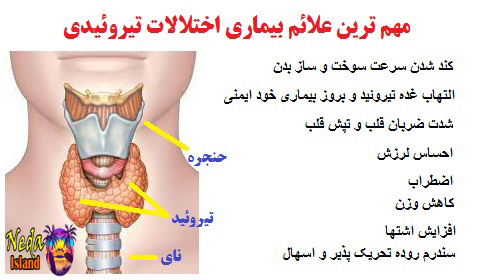 علائم بیماری اختلالات تیروئیدی یا تیروئید