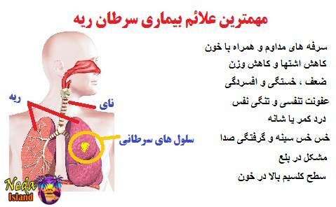 علائم بیماری سرطان ریه