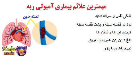 علائم بیماری آمبولی ریه