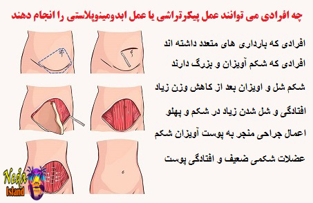 روش کار در پیکر تراشی