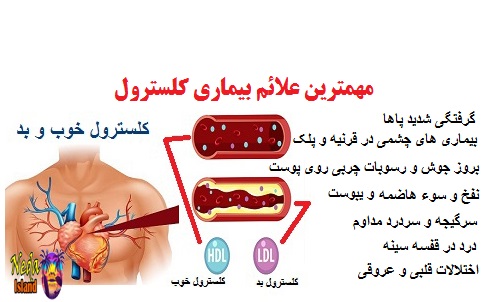 علائم بیماری کلسترول بالا