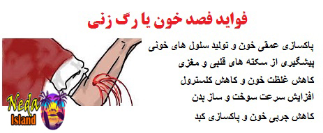 فواید فصد خون یا رگ زنی