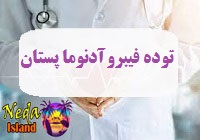 بيماري توده فیبروآدنوما پستان چيست 