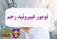بيماري تومور غیر سرطانی فیبروئید رحم چيست