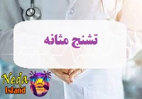 بيماري اسپاسم یا تشنج مثانه چيست 