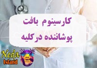بیماری کارسینوم بافت پوشاننده کلیه یا Transitional Cell Carcinoma of the Kidney چيست 