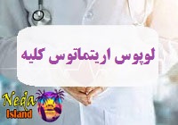 بیماری لوپوس اریتماتوس کلیه یا Lupus Nephritis چيست 