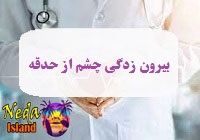 بيماري بیرون زدگی چشم از حدقه يا protrusion-of-the-eye-from-the-socket چيست