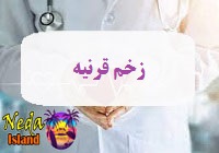 بيماري زخم قرنیه يا cornea-ulcer چيست