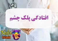 بيماري افتادگی پلک چشم يا eyelid-drooping چيست