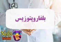 بيماري بلفاروپتوزیس يا blepharoptosis چيست