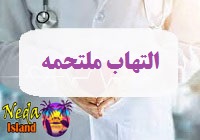 بيماري التهاب ملتحمه يا conjunctivitis چيست