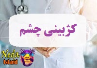 بيماري کژبینی چشم يا squinting-eyes چيست