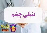 بيماري تنبلی چشم يا amblyopia چيست