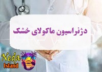 بيماري دژنراسیون ماکولای خشک يا dry-macular-degeneration چيست