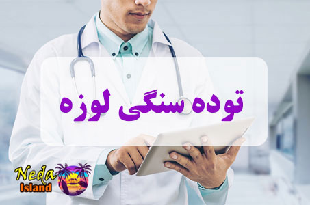 بيماري توده سنگی لوزه چيست