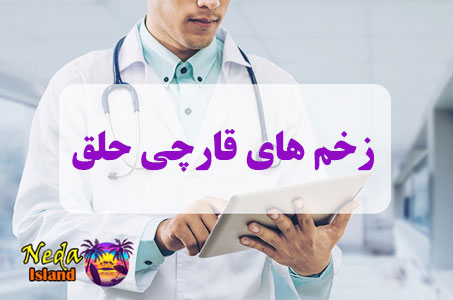 بيماري زخم‌ های قارچی حلق چيست