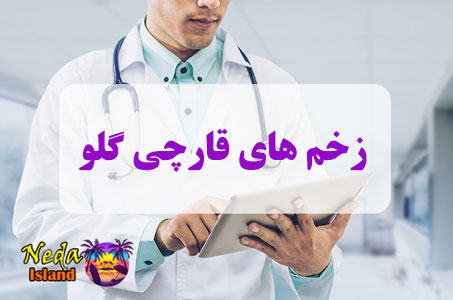بيماري زخم‌ های قارچی گلو چيست