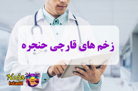 بيماري زخم‌ های قارچی حنجره چيست