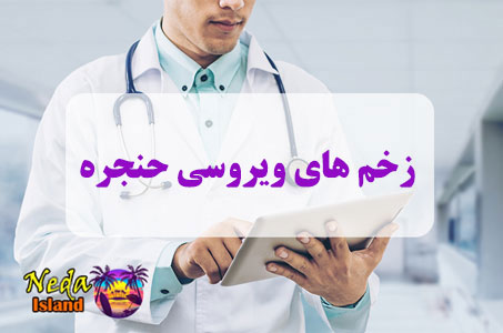 بيماري زخم‌ های ویروسی حنجره چيست 