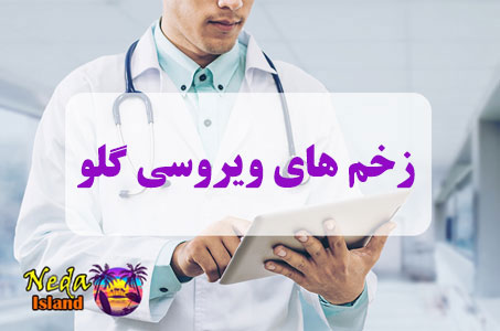 بيماري زخم‌ های ویروسی گلو چيست