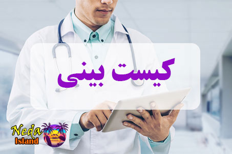 بيماري کیست بینی یا Nose cyst چيست 