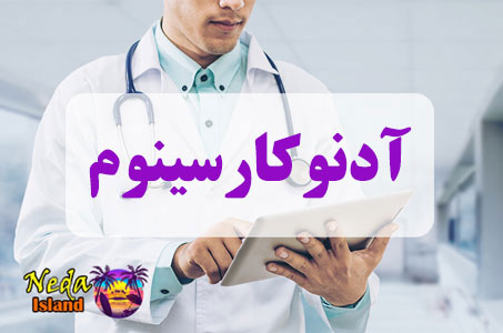 بيماري آدنوکارسینوم یا Adenocarcinoma چيست