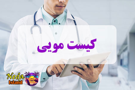 بيماري کیست مویی یا Hair cyst چيست