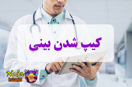 بيماري کیپ شدن بینی یا Nose capture چيست و علائم و روش درمان اين بيماري