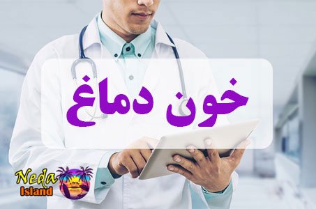 بيماري خون دماغ یا Nose blood چيست