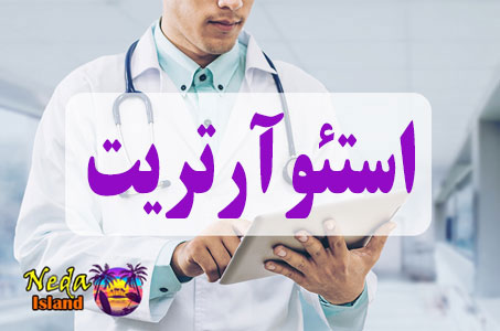 بيماري  استئوآرتریت یا Osteoarthritis چيست